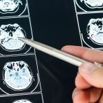 practical_guidance_for_serious_injury_claims_in_ne_20853_featured