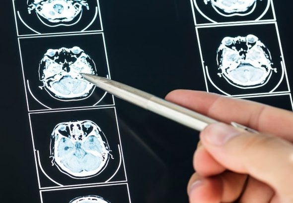 practical_guidance_for_serious_injury_claims_in_ne_20853_featured